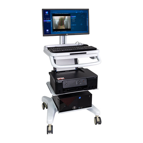 Dual-energy X-ray bone densitometerDEXA Pro-I