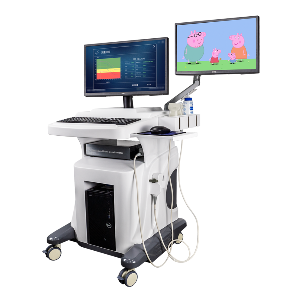 BMD-A1Good Quality Children/Adult Dual-screen dual probe Ultrasound Bone Densitometer for Detecting OsteoporosisBMD-A1 Dual-screen dual-probe