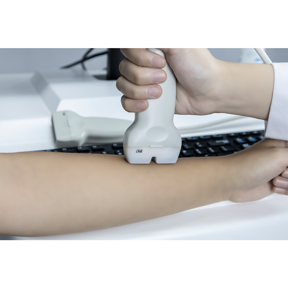 BMD-A1Good Quality Children/Adult Dual-screen dual probe Ultrasound Bone Densitometer for Detecting OsteoporosisBMD-A1 Dual-screen dual-probe
